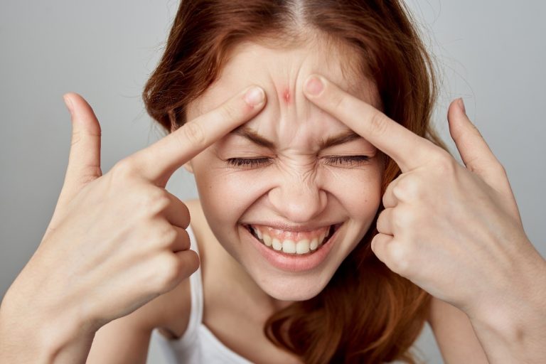 Boutons au visage : pourquoi devriez-vous éviter de les éclater ?